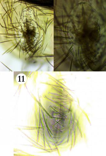 Erythracarus epigeus